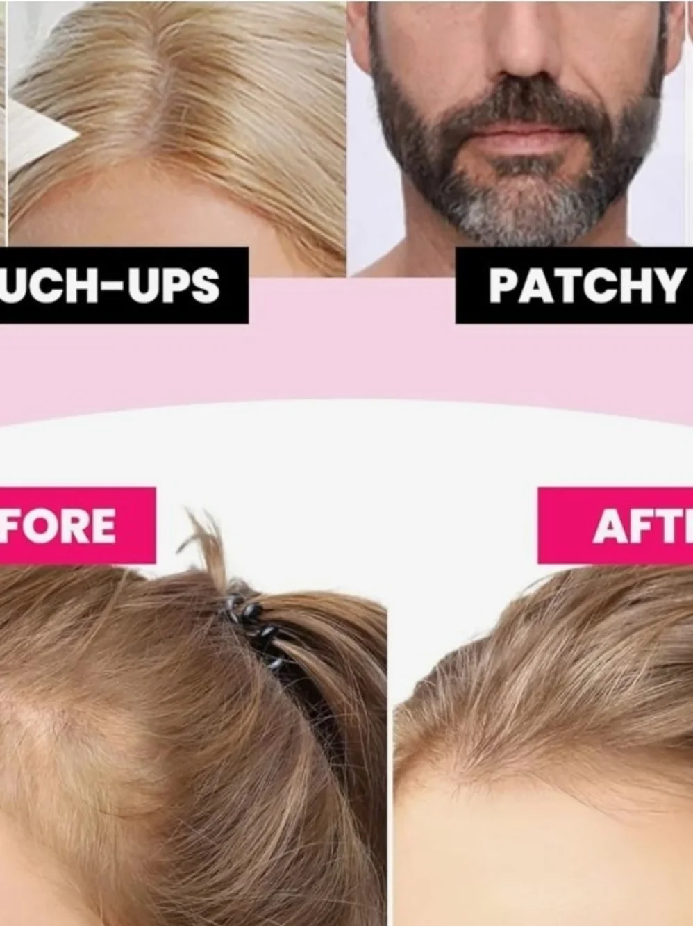 Velo. hair line